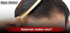 Saçkıran neden olur? Saçkıran hastalığının belirtileri nelerdir?