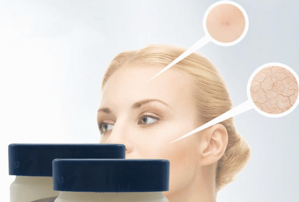 Vazelin Kremi Ne İşe Yarar? Vazelin yüze sürülür mü? 2 her-gun-yuze-vazelin-surmek-ne-olur