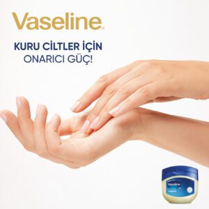 Vazelin Kremi Ne İşe Yarar? Vazelin yüze sürülür mü? 4 vaseline-krem-nelere-iyi-gelir
