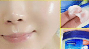 Vazelin Kremi Ne İşe Yarar? Vazelin yüze sürülür mü?