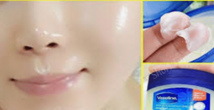 Vazelin Kremi Ne İşe Yarar? Vazelin yüze sürülür mü?